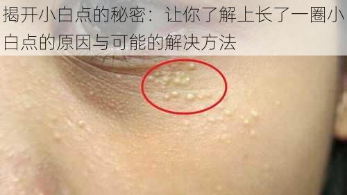 揭开小白点的秘密:让你了解上长了一圈小白点的原因与可能的解决方法