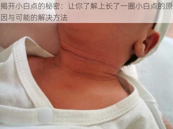 揭开小白点的秘密：让你了解上长了一圈小白点的原因与可能的解决方法